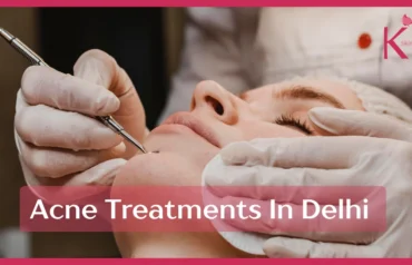 Best Acne Treatments in Delhi